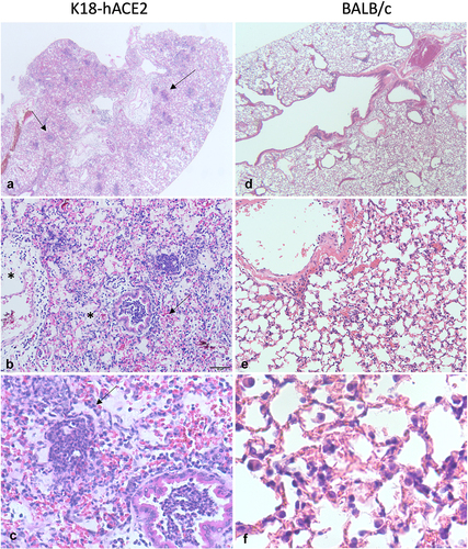 Figure 2. Lung pathology in mice infected with SARS-CoV-2. a-c K18-hACE2 mouse infected with 5 × 104 pfu SARS-CoV-2 WA10 that died on day 7. At low magnification (a), approximately 70% of the lung is hypercellular and there are multiple discrete foci of inflammation (arrows). The normal pulmonary architecture is obscured due to haemorrhage (arrow), oedema (stars), and inflammation (b). The alveolar and bronchiolar exudate is largely composed of neutrophils and there is rare type II pneumocyte hyperplasia (arrow) (c). (d-f) 6-week-old BALB/c mouse infected with 1 × 104 pfu SARS-CoV-2 MA10 that was euthanized on day 4. There is minimal change at low magnification (d). There are occasional areas of hypercellularity (e) where septa are mildly thickened due to congestion and increased lymphocytes and macrophages (f).