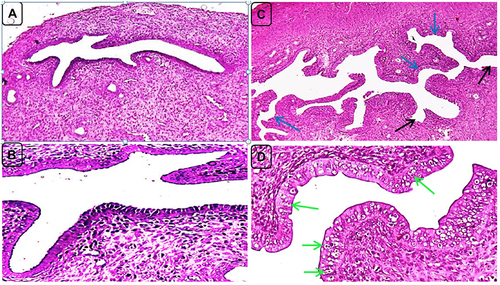 Figure 8 Uterine sections of negative control (NC) and PCOS rats on day 21. (A and B) NC rats showing normal uterine morphology represented by a normal looking endometrium with simple columnar epithelial lining and straight endometrial glands in the lamina propria. (C and D) PCOS rats exhibiting marked endometrial hyperplasia with profound, irregular endometrial folds toward the uterine lumen, cystic dilatation (black arrows) and convolution (blue arrows) of endometrial glands and rapid proliferation of endometrial epithelial cells as indicated by epithelial thickening and presence of many normal-looking mitotic figures (green arrows). H and E, (A and C) X100, (B and D) X400.