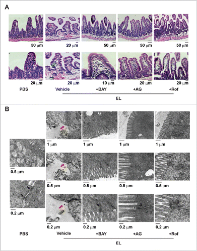 Figure 4. Histological and ultrastructural analyses of mouse intestine following EL infection. Mouse ileal loops were inoculated with EL with or without intraperitoneal administration of NF-κB inhibitor BAY 11-7082 (BAY), iNOS inhibitor aminoguanidine (AG), or COX-2 inhibitor rofecoxib (Rof). At 12 h post-inoculation, ileal loops were removed for histological and ultrastructural examinations. (A) Representative images of hematoxylin and eosin-stained tissues (upper panel, 40X; lower panel, 80X). Green arrow indicates dilated lacteal pattern. Orange asterisk indicates extended submucosa. Blue arrow indicates congested blood vessels. (n = 4 mice per group) (B) Representative images acquired from transmission electron microscope. Red arrow indicates irregular tight junctions. Black arrow indicates normal structure of tight junction (n = 4 mice per group)