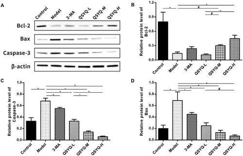 Figure 4. Effect of QSYQ on myocardial apoptosis related proteins in rats. (A) Western blot analysis of protein in the myocardium of rats. (B) The relative protein level of Bcl-2 in the myocardium. (C) The relative protein level of Capase-3 in the myocardium. (D) The relative protein level of Bax in the myocardium. *p < 0.01, #p < 0.05.