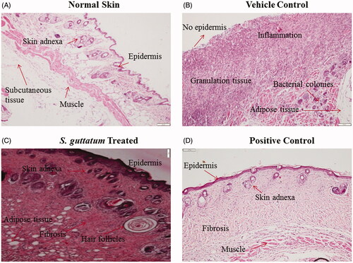 Figure 4. Histological images of (A) normal skin and burnt skin tissues treated with (B) vehicle, (C) S. guttatum extract and (D) positive control.