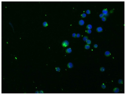 Figure 3 Nanoparticle uptake by MKN-45 cells revealed by fluorescence microscopy.Notes: Intracellular detection of ibuprofen-loaded PLGA NPs. Cells were imaged using a Leica fluorescence microscope at 40 × objective magnification. A total of 2 × 104 MKN-45 cells were seeded on Millicell EZ slides as described in the Materials and methods and treated with ibuprofen-loaded PLGA NPs for 2 hours. The nuclei were stained with DAPI. The localization of NPs was intracellular.Abbreviations: PLGA, poly(lactic-co-glycolic acid); NPs, nanoparticles; DAPI, 4′,6-diamidino-2-phenylindole.