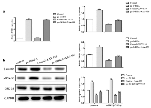 Figure 4. INHBA facilitated breast cancer cell invasion and EMT through activation of the Wnt/β-catenin signaling pathway. A. Wnt/β-catenin signaling pathway associated mRNA and protein expressions were assessed using qRT-PCR and western blot assays