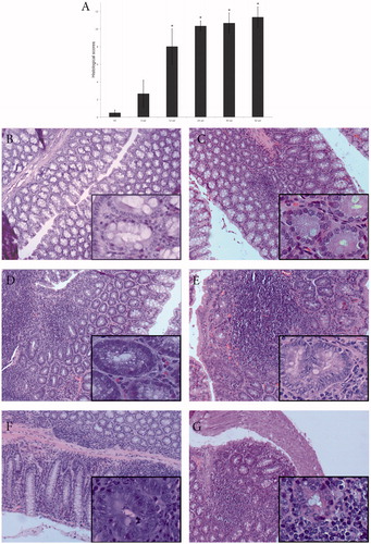 Figure 1. Histological changes in intestinal tissues of mice exposed to ENDO. (A) Histological scores of ENDO-mediated changes in sections with respect to scoring matrix in Table 1. HC = healthy control. Among ENDO hosts, *p < 0.05 for Week 6 samples vs. those at Weeks 12, 24, 30 and 42. (B–G) Representative H&E-stained sections demonstrating varying degrees of inflammation in the intestinal tissues. (B) Week 24: healthy control with normal epithelial architecture. Inset: normal crypt. (C) Week 6: ENDO mouse with some crypts with thickened epithelia and altered luminal openings, signs of weak inflammation: edema, and lymphocyte infiltration. Inset: crypt with mucosal depletion. (D) Week 12: ENDO mouse, the majority of crypts show changed structure with diminished mucus secretion, and moderate inflammation with lymphocyte infiltration. Inset: crypt with nuclear irregularities, loss of cell polarity. (E) Week 24: ENDO mouse with increase in aberrant crypt formation, strong vascular congestion. Inset: aberrant crypt with nuclear proliferation, prominent nucleoli. (F) Week 30 (six week post-final ENDO dose): treated mouse with continuous vascular congestion and lymphocyte infiltration. Inset: aberrant crypt with nuclear irregularity. (G) Week 42 (18 weeks post-final ENDO dose): treated mouse with severe colonic inflammation. Inset: example of aberrant crypt surrounded by infiltrating cells. Magnification =10×, inset =40×.