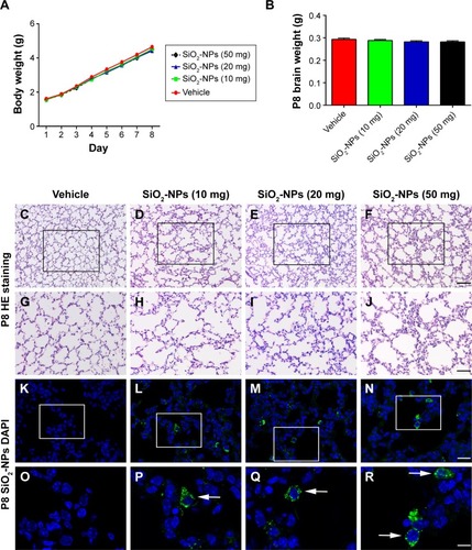 Figure 3 SiO2-NP treatment induced inflammatory response in the lungs of the 8-day-old mice without alteration in the body and brain weight.Notes: (A) The effects of SiO2-NP exposure on the average body weights of mice (n=10 per group). (B) The effects of SiO2-NP exposure on brain weight at P8 (n=8 per group). The data are presented as the mean ± SEM. (C–F) The structure of the lung as illustrated by HE staining for the groups: Vehicle, SiO2-NPs (10 mg), SiO2-NPs (20 mg), and SiO2-NPs (50 mg). (G–J) The images are higher-power views of C–F. (K–N) The locations of the SiO2-NPs labeled by FITC as revealed by immunofluorescent staining in the four groups: Vehicle, SiO2-NPs (10 mg), SiO2-NPs (20 mg), and SiO2-NPs (50 mg). (O–R) The images are higher-power views of K–N. Arrows highlight the FITC-labeled SiO2-NP burden observed in alveolar macrophages. The scale bar in F =100 µm and applies to C–F; in J the scale bar =50 µm and applies to G–J; in N the scale bar =25 µm and applies to K–N; and in R the scale bar =10 µm and applies to O–R.Abbreviations: SiO2-NPs, silica nanoparticles; FITC, fluorescein isothiocyanate; SEM, standard error of the mean; DAPI, 4′,6-diamidino-2-phenylindole.