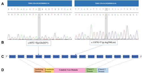 Figure 4 TGM1 mutations. (A) and (B) TGM1 mutations in the proband. (C) TGM1 structure. TGM1 has 15 exons and the translation start is located in the second exon.Citation26 (D) Protein domains of TGM1. It consists of five chains (817 amino acids): anchoring domain (1–92), β-sandwich domain (94–246), catalytic domain (247–572), β-barrel 1 domain (573–688), and β-barrel-2 domain (689–817).Citation19