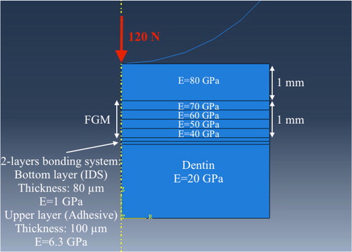 Figure 1. Example of an FGM axisymmetric model.