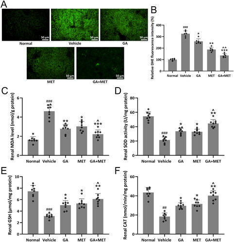 Figure 5. Effects of metformin combined with gallic acid treatment on renal oxidative stresses in mice model of diabetic kidney disease at the end of 4 weeks treatment. (A) Representative images of dihydroethidium (DHE) staining for the assessment of superoxide production and (B) bar diagram showing the percent of DHE fluorescence intensity. The data were gotten from six mice in each group and the data point indicates the average of single mouse from eight random fields. The levels of MDA (C), SOD (D), GSH (E) and CAT (F) in renal tissues were measured. Eight mice were used for each group. Data are presented as mean ± SD. ##p < 0.01, ###p < 0.001 compared to normal. *p < 0.05, **p < 0.01, ***p < 0.001 compared to vehicle. ^p < 0.05, ^^p < 0.01 compared to MET group.