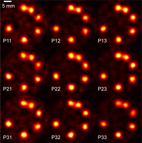 Figure 8 Reconstructed images for phantom (I) acquired using individual sub-projections.Note: Results are shown for the XFCT setup with a multi-pinhole size of 2 mm, 100 billion particles and a one-sided detector.Abbreviation: XFCT, X-ray fluorescence computed tomography.