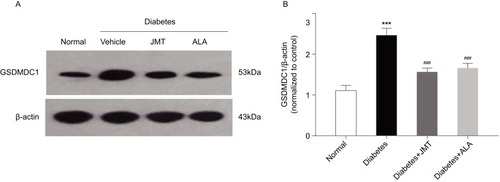 Figure 7 JMT reduced GSDMD expression in SNs of diabetic rats.