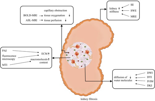 Figure 1. The pathological foundation of imaging techniques to assess kidney fibrosis. BOLD-MRI: Blood oxygenation level-dependent MRI; ASL-MRI: Arterial spin labeling MRI; SE: strain elastography; SWE: shear wave elastography; MRE: magnetic resonance elastography; PAI: photoacoustic imaging; ECM: extracellular matrix; MTI: magnetization transfer imaging; DWI: diffusion weighted imaging; DTI: diffusion tensor imaging; IVIM: intravoxel incoherent motion imaging; DKI: diffusion kurtosis imaging. The increase and deposition of ECM lead to the increase of kidney stiffness and macromolecule content, meanwhile, decrease the tissue oxygenation and perfusion, restrict the diffusion of water molecules. This pathologic change is the foundation of different imaging techniques to assess kidney fibrosis.