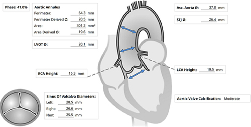 Figure 1 Preoperative multislice helical CT assessment.