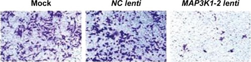 Figure 7 Comparison of invasion of MKN45 cells in mock, NC lenti group, and MAP3K1-2 lenti group detected by Transwell assay. MAP3K1-2 lenti group compared with mock and NC lenti group (mock: MKN45 without lentivirus transfection). Magnification ×100.