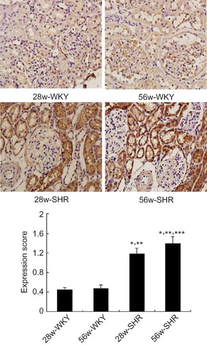 Figure 2. Immunohistochemical micrographs of ICAM-I staining in the kidneys of 28w-WKY, 56w-WKY, 28w-SHR, and 56w-SHR (original magnification ×400). Renal tissue expression of ICAM-1 was scored using four levels, and average value was obtained from analyses of 100 glomeruli in each group. Data are shown as means ± SD.Notes: *p < 0.05 versus 28w-WKY rats; **p < 0.05 versus 56w-WKY rats; ***p < 0.05 versus 28w-SHR rats.