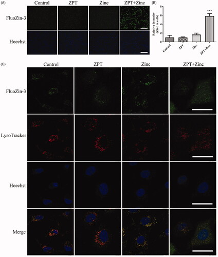 Figure 3. ZPT induced Zinc accumulating in lysosomes. (A) Fluorescent photomicrographs of FluoZin-3-stained SKOV3/DDP cells were taken after different treatments. From left to right rows: Cells were cultivated in normal medium or treated with 0.35 μM Zinc pyrithione, 20 μM Zinc, 0.35 μM Zinc pyrithione combined with 20 μM Zinc for 1 h in media. Treatment with ZPT combined with Zinc significantly increased intracellular Zinc levels compared with other conditions. (B) Quantification of Zinc fluorescent in four groups of SKOV3/DDP cells. (C) Fluorescent confocal micrographs of FluoZin-3-AM and LysoTracker Red stained SKOV3/DDP cells after treatments. Most intracellular labile Zinc showed apparent overlap with LysoTracker fluorescence. The typical pictures were shown from three independent experiments. ***p < .001. Bar = 40 μm.