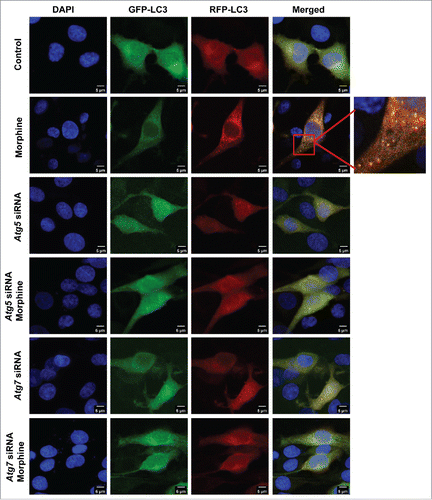 Figure 2. Knockdown of Atg5 or Atg7 reverses the increased autophagic flux in response to morphine treatment in PC12 cells. Cells were transfected with NC siRNA, Atg5 siRNA or Atg7 siRNA for 24 h, then were infected with mRFP-GFP-LC3 lentivirus for 24 h. Infected cells were treated with or without morphine (100 μM) for 24 h. Morphine treatment increased the maturation of autolysosomes as shown by the increased red puncta of mRFP-GFP-LC3 in cells, and this effect could be restored by knockdown of the Atg5 or Atg7 gene. Data shown are representative of 3 experiments.