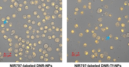 Figure 7 K562 cells observed by digital confocal microscope.Note: The blue arrow demonstrates drug-loaded NPs were endocytosed in necrosis and apoptotic cells.Abbreviations: NIR, near-infrared; DNR, daunorubicin; Tf, transferrin; NPs, nanoparticles.