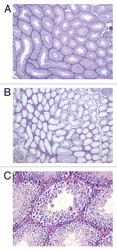 Figure 3 Spermatogenesis is defective in 50–80% of the seminiferous tubules of transgenic mice. (A) H&E staining in wild type adult mouse testicular sections, showing complete spermatogenesis in all tubules (100x). (B) Cyclin E transgenic adult mouse testis section showing most seminiferous tubules lacking germ cells and a few with complete spermatogenesis (100x). (C) Complete spermatogenesis in transgenic mice, demonstrating that meiosis and spermiogenesis is unaffected in the transgenic animals.