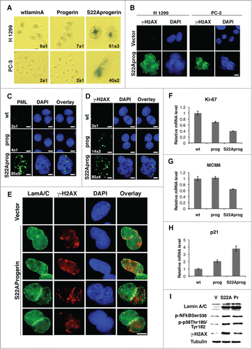 Figure 6. S22A-progerin induces tumor cell senescence. (A) Senescence associated β-galactosidase staining in the indicated cell lines expressing wild type lamin A (wtlamin A), progerin or S22A-progerin. (B) Immunofluorescence for γ-H2AX in the indicated cell lines. (C-D) Immunofluorescence for PML bodies (C) or γ-H2AX (D) of U-2 OS cells expressing wild type lamin A (wt), progerin (prog) or S22A-progerin (S22Aprog). The percent and S.D labeled cells are indicated at the bottom right of each panel. Magnification = 10 μm. (E) Immunoflourescence of cells co-stained for lamin A and γ-H2AX (F-H) qPCR for genes whose expression change with senescence in U-2 OS cells. (I) Immunoblots for the indicated proteins of U-2 OS cells with empty vector (V), S22A-progerin (S22A) or progerin (Pr). All markers in A-I were measured at day 5 post-infection.