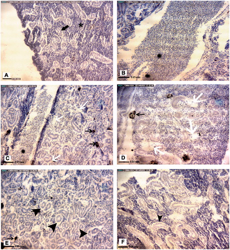 Figure 4. Representative photomicrographs of A. latus head kidney tissue structures. (A) Control site: Lymphoid tissue (), renal tubules (black arrow). (B) Petrochemical Station: Hemorrhage (black ). (C) Gaafari Station and (D) Majidieh Station: Melano-macrophage aggregations (black arrow), Empty spaces between cells (white arrows), Hemorrhage (black ). (E) Ghazaleh Station and (F) Zangi Station: Lifting of tubular basement membrane (black chevrons). All samples; H&E-stained, magnification = ×725).