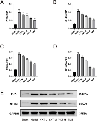 Figure 13 Effects of YXT on NF-κB/PKC signaling pathway in HF rates; (A) PKC mRNA expression. (B) NF-κB p65 mRNA expression. (C) Relative protein expression of PKC. (D) Relative protein expression of NF-κB. (E) Protein analysis of six groups detected the protein expression of PKC and NF-κB. n=5. ##P<0.01 vs sham group; **P<0.01 vs model group. All values are indicated as mean ± SD.