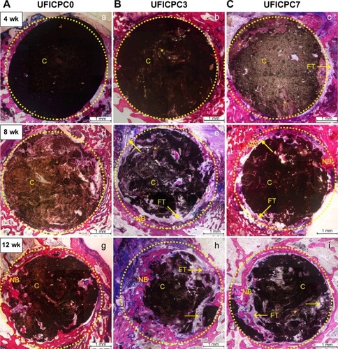 Figure 8 Representative histological section of three UFICPC composites, (A) UFICPC0, (B) UFICPC3 and (C) UFICPC7, after implantation for 4 (a–c), 8 (d–f) and 12 weeks (g–i).Note: Dotted circle covers original area of samples (Φ5 mm), arrow (→) indicates the fibrous capsule wall, and *shows the ultrafine PCL fibers.Abbreviations: C, composite; CPC, calcium phosphate cement; FT, fibrous tissue; NB, new bone; PCL, poly(ε-caprolactone); UFICPC, ultrafine fiber-incorporated CPC; wk, weeks.