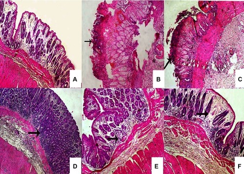 Figure 6 Histopatholological examination of rabbit colonic tissues.