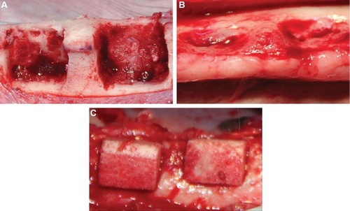 Figure 1 (A) Standardized box-type defects (9 mm in height from the crestal bone, 6 mm in depth from the surface of the buccal bone, and 12 mm in width mesiodistally; distance between defects: 4 mm). The defects were surgically created at the buccal aspect of the alveolar ridge after tooth extraction in the lower jaws (buccal view). (B) A chronic-type defect morphology was achieved after 2 months of submerged healing (occlusal view). (C) After defect reshaping, nano-hydroxyapatite/coralline blocks were grafted to fill the defect sites (buccal view).