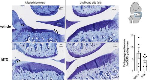 Figure 6 Representative histopathological alterations after MIA injection in the knee joint. Representative photos of the affected knee (right) and unaffected knee (left) joint coronal sections of 5 μm width of the vehicle and MTX groups at day 28 after MIA injection. Sections are stained with toluidine blue. Damage to the cartilage surface with loss of proteoglycans and chondrocytes (arrows) on medial tibial condyles is observed. Cartilage degeneration score by the OARSI grading system showed no significant differences in the scores between the two groups (Mann–Whitney U-test, P=0.28).