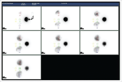 Figure 4. The 7 imaging plots from the gamma camera. The images were obtained in a preliminary survey that was performed using a similar protocol. The phantom was measured in model A, as the darkest spot was recorded in ROI (1) on the right side of the scanned images. In addition, the ROIs were marked and recorded by well-trained radiologist directly from the clinical monitor beside the gamma camera facility.