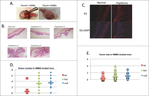 Figure 1. The gross and pathological findings of NMBA treated mice. (A) Representative papillomas recovered from fore stomach. Enlarged lymph nodes, not pictured, were also observed. (B) H&E staining of normal fore stomach and papillomas. (C) Immunofluoresent staining of normal fore stomach or papilloma from NMBA treated FBXO4+/− mice. (D) Quantified tumor numbers from NMBA treated mice of the indicated genotypes. P < 0.01 between wt/het and wt/null groups, respectively. The P > 0.05 between het/null groups. (E) Quantified tumor size in NMBA treated groups. P < 0.01 between wt/het and wt/null groups, respectively. The P > 0.05 between het/null groups.