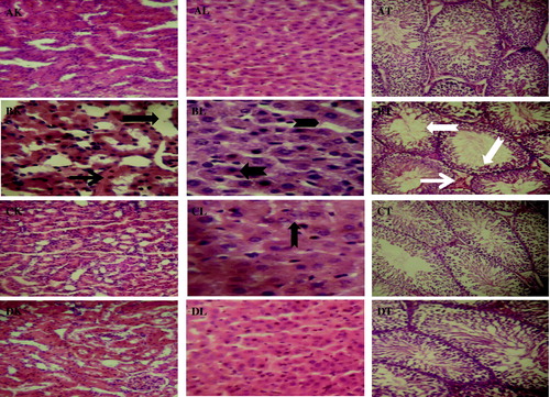 Figure 5. Histopathology guide of kidney, liver, and testes of control and STZ-induced diabetic rats treated with Garcinia kola seed. The upper panel (AK, AL, and AT) shows representative photomicrographs of kidney, liver, and testes from control rats, respectively. STZ-induced diabetic control rats showed severe histopathologic alterations in kidney, liver, and testes of rats (BK, BL, and BT). Tubular necrosis (black arrow), interstitial, and periglomerular cellular infiltration by mononuclear cells (line arrow), periportal fatty infiltration (notched arrow), hydropic degeneration of hepatocytes (chevron), interstitial congestion and edema (white arrow), and decreased germinal epithelium (white notched arrow). The investigated organs from STZ-induced diabetic rats administered with Garcinia kola seed appeared structurally and functionally normal but with a very mild renal interstial congestion and a few periportal cellular infiltration in the liver (CK, CL, and CT). Normal rats administered with Garcinia kola seed alone showed regular architecture (DK, DL, and DT). Original magnification: 160×.