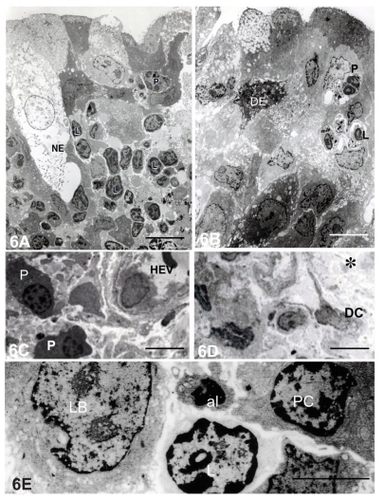 Figure 6 Electron micrographs of diffuse lacrimal sac lymphoid tissue 1 month after Staphylococcus aureus inoculation. (A) Polymorphonuclear leukocytes (P) and lymphocytes (L) were present in the epithelium. Bar = 7 μm. (B) Secretory granules were present in the apical portion of the epithelial cells. Bar = 7 μm. (C) Plasma cells (PC) were situated in the connective tissue stroma. Bar = 12 μm. (D) A dendritic cell (DC) situated among collagen fibers (*). Bar = 10 μm. (E) High magnification of the aggregated lymphoblasts (LB), L, and PC in the lamina propria. An apoptotic lymphocyte (AP) was also present. Bar = 2 μm.