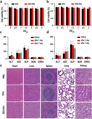 Figure 7 Biosafety analysis. (a and b) Viability of MB49 cells after treatment with GVs or ZD2-GVs at OD500 0 to 3.0 for 24 h (a) and 48 h (b). (c and d) The levels of liver and kidney function indexes of mice received with the same volume of PBS (c) or GVs (d). The units of ALT, AST and ALP are UL−1; the units of BUN and CREA are mg dl−1 and µmol L−1, respectively. Injection of PBS with same volume was set as control groups. (e) Representative H&E sections of the main organs (heart, liver, spleen, lung, and kidney) from the mice received with PBS, GVs, or ZD2-GVs after 7 days. Scale bars: 50 µm. Data represent the mean ± SD from 3 independent experiments.