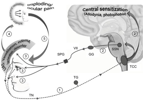 Figure 2 Imploding/ocular pain might be a consequence of the trigemino-autonomic reflex activation: a hypothesis.