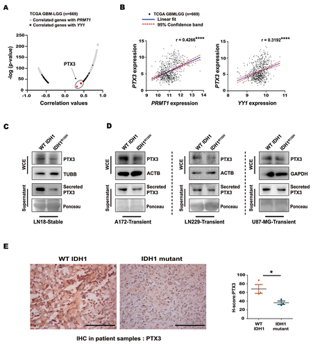 Figure 2. Differential expression of PTX3 in WT IDH1 and IDH1R132H gliomas. (A) Volcano plot for Pearson correlations of PRMT1 and YY1 with PTX3 mRNA levels in TCGA GBM-LGG cohort (n = 669). (B) Pearson correlation coefficient analysis of PRMT1 and YY1 mRNA with PTX3 mRNA levels in TCGA GBM-LGG dataset (n = 669). r represents the Pearson correlation coefficient. ****P < 0.0001. (C) Immunoblots depicting levels of whole cell as well as secreted PTX3 in WT IDH1 and IDH1R132H cells. (D) Immunoblots shows whole cell as well as secreted PTX3 levels in A172, LN229 and U87-MG cells upon transient transfection with WT IDH1 and IDH1R132H. The image of loading control used for PTX3 is the same as that used for YY1 (Figure 1G) in case of A172 cells. (E) Representative images of immunohistochemical staining show diminished PTX3 expression in IDH1 mutant glioma patients as compared to those harboring WT IDH1 gliomas. Scale bar: 100 µm. Data are presented as mean ± s.e.m. n = 3 WT IDH1 and n = 3 IDH1 mutant patients. *P < 0.05 (two-tailed Student’s t-test). Blots are representative of n = 3 biological replicates. WCE, whole cell extract.