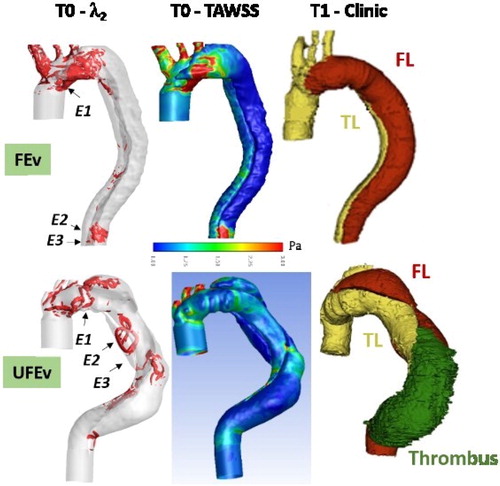 Figure 2. λ2 criterion during deceleration at T0, TAWSS at T0 and clinical events at T1, for FEv (top) and UFEv (bottom).