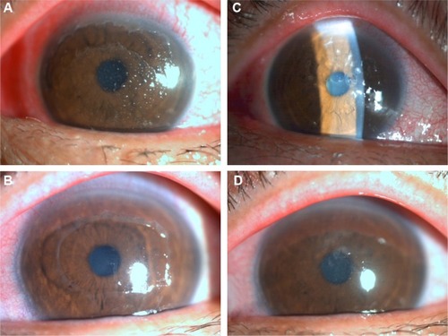 Figure 1 Case 1: a 44-year-old male.