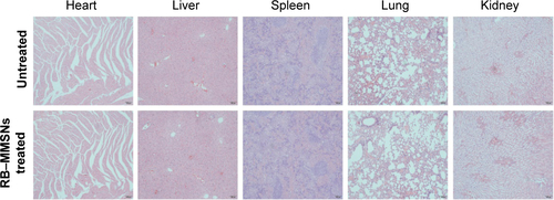 Figure S3 H&E-stained images of major organs collected from healthy C57BL/6J mice untreated and RB−MMSNs injected 20 days later. Scale bar =100 μm.Abbreviations: H&E, hematoxylin and eosin; RB−MMSNs, polyethylene glycol-b-polyaspartate-modified rose bengal-loaded magnetic mesoporous silica.