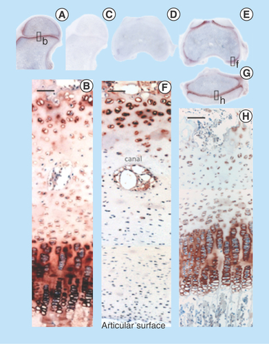 Figure 11.  Immunolocalization of FGF-18 expressed by articular and growth plate chondrocytes in the hip (A) femoral condyle (E) and tibial plateau of the knee (G). Perlecan is particularly prominently expressed by the deep hypertrophic chondrocytes in articular cartilage (F) and the columnar hypertrophic chondrocytes of the growth plates of the femur and tibia (H).