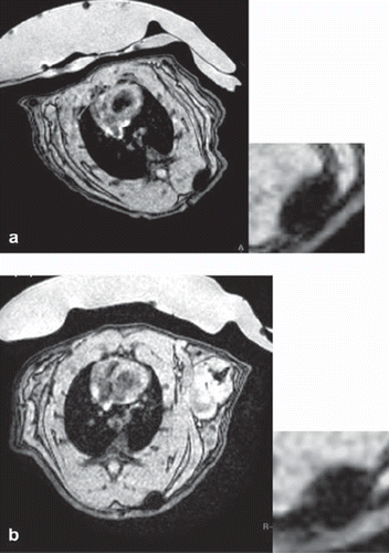 Figure 8. 1 × 106 MSC (passage 4) labeled with MU-Wuest 4 100 μg Fe/mL in 1 mL of a collagen scaffold 2 × 3 × 2-mm subcutaneous implant. (a) MRI taken 2 days after implantation; (b) MRI 25 days after implantation. As a control, the same number of unlabeled MSC in a scaffold was implanted on the contralateral side. No T2/T2* signal could be detected at the implantation site of the control.