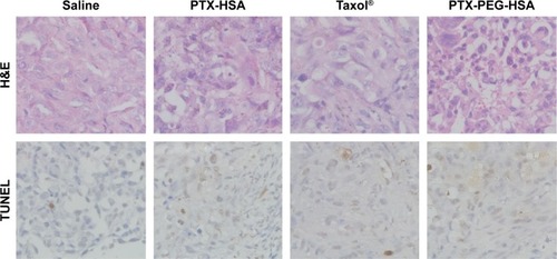 Figure 8 H&E staining and TUNEL analysis of tissue sections of tumor excised from the mice 20 days after treatment.Abbreviations: PTX, paclitaxel; HSA, human serum albumin; PEG, polyethylene glycol; H&E, hematoxylin and eosin; TUNEL, terminal deoxynucleotidyl transferase-mediated nicked labeling.