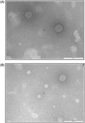 Figure 1. TEM image of (A) blank transfersomes and (B) ETF20 transfersomes (scale: 500 nm).