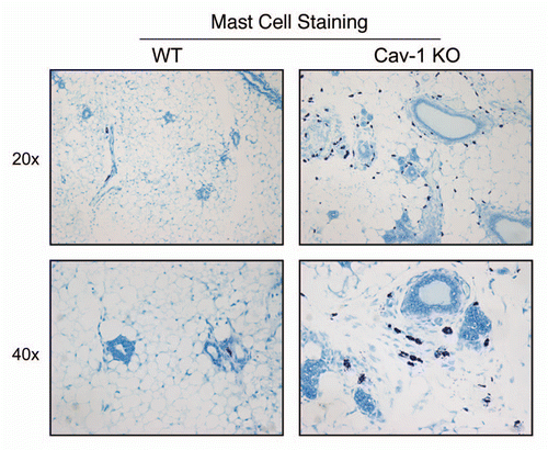 Figure 8 Cav-1 (−/−) mammary fat pads show the upregulation of mast cells. Mammary fat pads from wild-type (WT) and Cav-1 (−/−) null mice were harvested and processed for histo-chemical staining. Note that Cav-1 (−/−) null mammary fat pads show an abundance of mast cells. Original magnifications, 20x and 40x.
