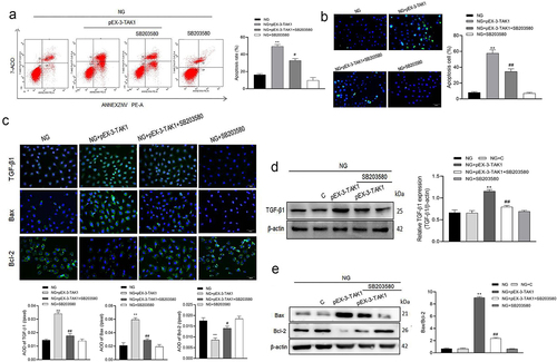 Figure 4. Effects of SB203580 on TAK1 overexpression induced apoptosis in HK-2 cells. (a) Apoptosis was detected by flow cytometry; (b) Apoptosis was detected by TUNEL; (c) The protein expression of TGF-β1, Bax and Bcl-2 in HK-2 cells was detected by immunofluorescence staining. (d) The protein expression of TGF-β1 was detected by Western blot; (e) The protein expression of Bax and Bcl-2 was detected by Western blot; All experiments were repeated 3 times. *P < 0.05 vs. NG group, #P < 0.05 and ##P < 0.01 vs. NG+ pEX-3-TAK1 group. NG, 5.5 mmol/l glucose; NG+ pEX-3-TAK1, 5.5 mmol/L glucose+0.5 mg/L pEX-3-TAK1; NG+ pEX-3-TAK1+ SB203580; 5.5 mmol/L glucose+0.5 mg/L pEX-3-TAK1 + 15 μmol/L p38MAPK inhibitor SB203580.