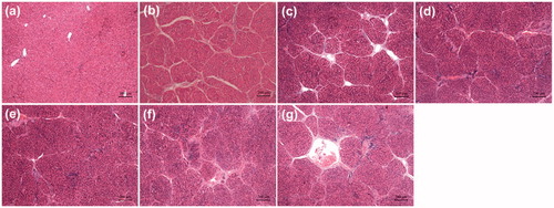 Figure 3. Effects of different drug formulations on the histological changes in the liver of CCl4-treated rats as shown by H&E staining. (a) Naive group, (b) Vehicle group (positive control), (c) Free-Cur group, (d) Cur-NLCs group, (e) Cur-mNLCs group, (f) B-mNLCs group, (g) Colchicine group. Data were presented as a typical microscopic view of each group.