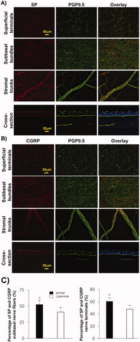 Figure 3. Relative content of SP and CGRP sensory neuropeptides in chicken corneas. (A, B) Representative images showing the expression of SP- and CGRP-positive nerves in the central subbasal nerve bundles, terminals, and limbal stromal trunks. Cross-sections double-labeled with PGP + SP or CGRP and counterstained with DAPI showing the detailed nerve structure in a transverse view. (C) Percentage of positive SP or CGRP subbasal nerves with respect to total nerve area (PGP9.5 nerves) in each image recorded with a 20× objective lens. Sixty images for each neuropeptide and the same number of images for PGP9.5 were recorded from four corneas. Data expressed as average ± SD. *P< 0.001.