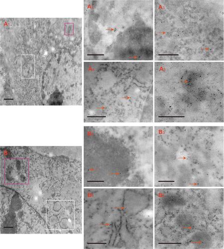 Figure 3 Immunoelectron micrographs of TRPA1-labeled colloidal gold particles in HOD-like cells (arrows). The colloidal gold particles observed in the whole cell (A1, ER membrane in white box and mitochondria in black box), nuclei (A2), cytoplasm (A3), ER membrane (A4) and mitochondria (A5). After treatment with TNF-α, the colloidal gold particles observed in the whole cell (B1, ER membrane in white box and mitochondria in black box), nuclei (B2), cytoplasm (B3), ER membrane (B4) and mitochondria (B5). (A1, B1: scale bars=1 μm, A2–A5, B2–B5: scale bars=200 nm).Abbreviations: TRPA1, transient receptor potential ankyrin 1; HOD, human odontoblast; ER membrane, endoplasmic reticulum membrane; TNF-α, tumor necrosis factor-α.
