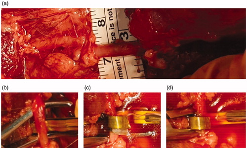 Figure 4. EIS was conducted on (a) left swine femoral artery of which diameter was 3 mm. Experiment followed the protocol of (b) to insert the instrument beneath an artery and measure impedance, (c) to induce shape recovery and measure impedance, and (d) to pull FPCB until it contacts an artery and measure impedance (thermocouple probe was tightened during pulling the FPCB).