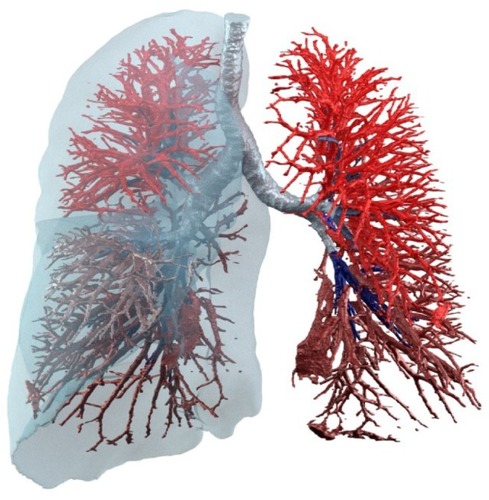 Figure 1 Functional respiratory imaging can describe vascular structures and blood vessel density as well as lobe and lung expansion and, therefore, indicate the image-based ventilation–perfusion ratio.